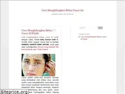 Sites similar to penghilangbekascacar.wordpress.com