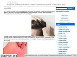 Sites similar to picores.info