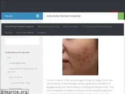 Sites similar to pimple.com.sg