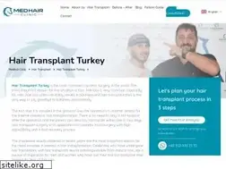 Sites similar to pingus.cx