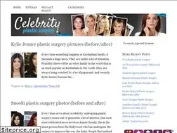 Sites similar to plasticsurgerykpop.com