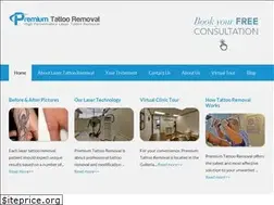 Sites similar to premiumtattooremoval.com