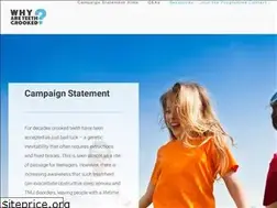 Sites similar to preventcrookedteeth.com