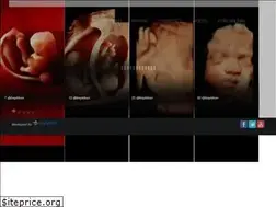 Sites similar to progennitiki-diagnosi.gr