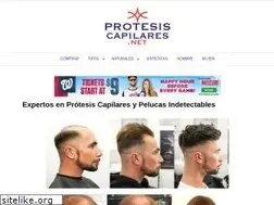 Sites similar to protesiscapilares.net