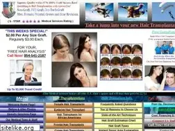 Sites similar to qualityhairtransplant.com