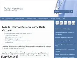 Sites similar to quitarverrugas.com