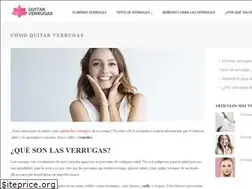 Sites similar to quitarverrugas.net