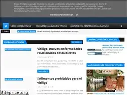 Sites similar to redvitiligo.blogspot.com