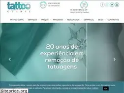 Sites similar to remocao-tatuagem.pt