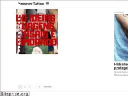 Sites similar to removertattoo.com.br