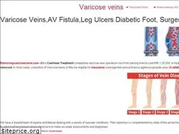 Sites similar to removingvaricoseveins.com