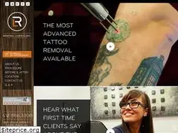 Sites similar to renewallaser.com