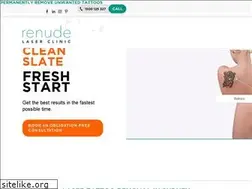 Sites similar to renudelaser.com.au