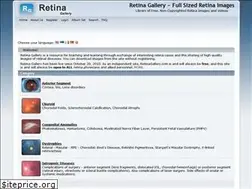 Sites similar to retinagallery.com
