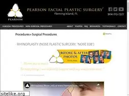 Sites similar to rhinoplastynewyorkcity.com