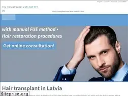 Sites similar to rubenhair.eu