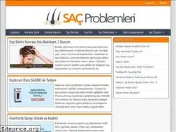 Sites similar to sacproblemleri.com