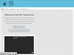 Sites similar to safeskintagremoval.org