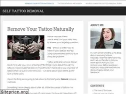 Sites similar to selftattooremoval.com
