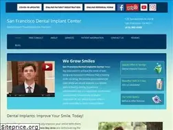Sites similar to sfdentalimplants.com