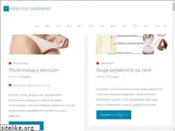 Sites similar to simptomy-foto.ru
