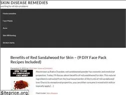 Sites similar to skindiseaseremedies.com