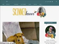 Sites similar to skinnedknees.net
