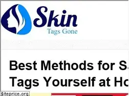 Sites similar to skintagsgone.com