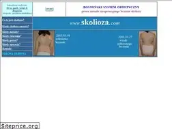 Sites similar to skolioza.com