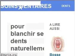 Sites similar to soindentaire.com