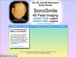 Sites similar to sonosmile.com