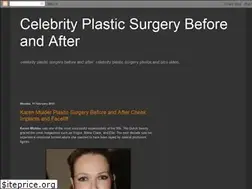 Sites similar to splasticsurgery.blogspot.com