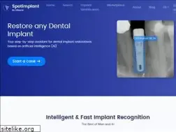 Sites similar to spotimplant.com