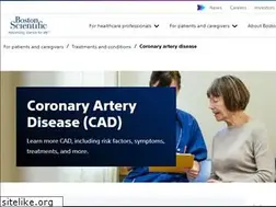Sites similar to stent.com