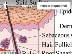 Sites similar to stophairfall.org