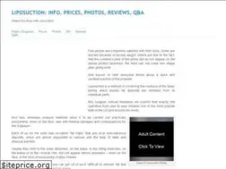 Sites similar to surgery-lipo.com