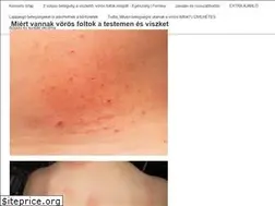 Sites similar to szilviizvilag.hu