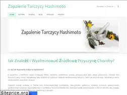 Sites similar to tarczycahashimoto.pl