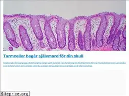 Sites similar to tarmsjukdomar.se