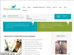 Sites similar to tattooremovals.co.nz