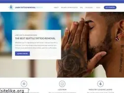 Sites similar to tattooremovalseattle.com