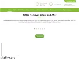 Sites similar to tattoovanishinc.com