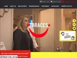 Sites similar to tbraces.com