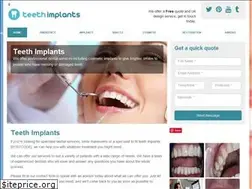 Sites similar to teeth-implants.co.uk