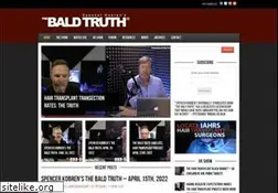 Sites similar to thebaldtruth.com