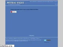 Sites similar to themitralvalve.org
