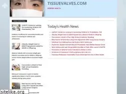 Sites similar to tissuevalves.com