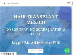 Sites similar to tjhairtransplants.com