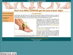 Sites similar to toe-nail-fungus.info
